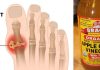 How To Use Apple Cider Vinegar For Gout? Apple cider vinegar for gout