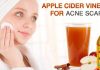 How To Use Apple Cider Vinegar For Acne Scars? Apple cider vinegar for acne scars