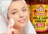 Can You Use Apple Cider Vinegar For Acne? Can You Use Apple Cider Vinegar For Acne