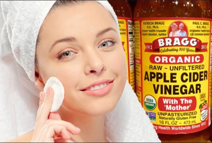Can You Use Apple Cider Vinegar For Acne Can You Use Apple Cider Vinegar For Acne