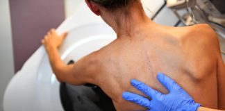 What to Look For When Searching For a Cancer Expert Searching For a Cancer Expert