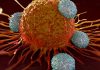 Different Types of Cancer Different Types of Cancer
