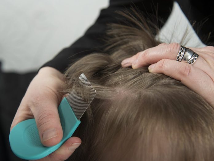How To Know If You Have Lice