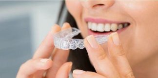 9 Reasons for Teenagers to Choose Clear Aligners
