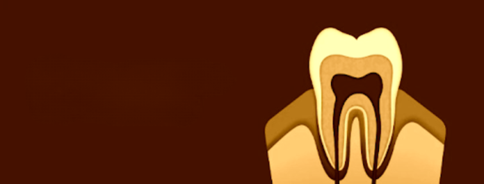 how to stop sensitive teeth pain immediately